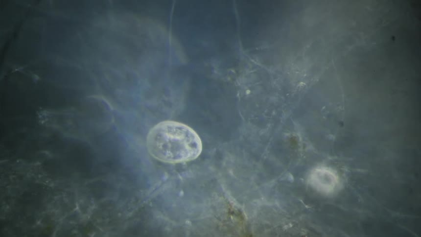 Close up of microscopic organisms floating in liquid