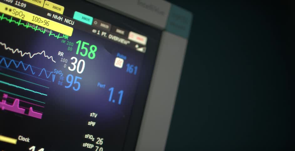 A piece of medical equipment monitor with changing numbers and graphs in various colors