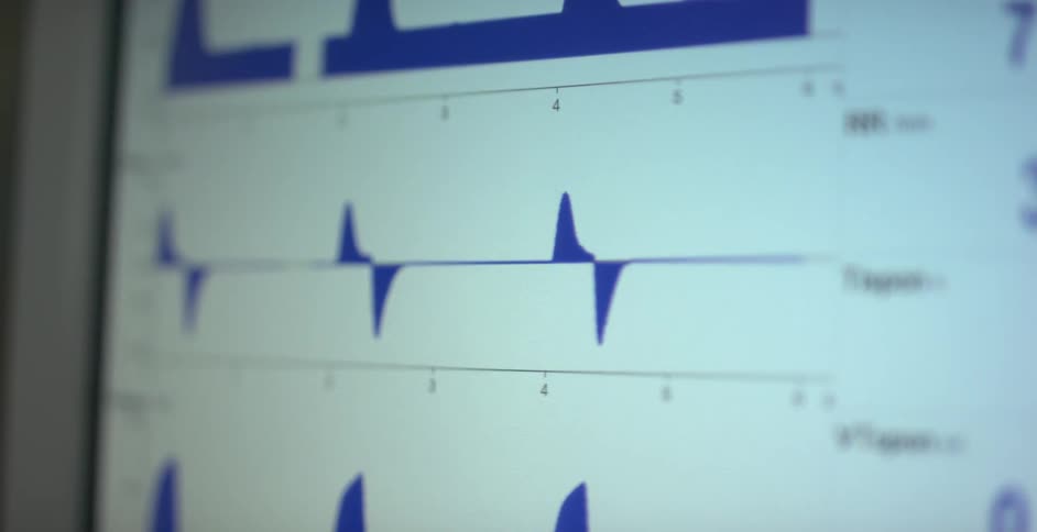 A heart and pulse monitor with colors and numbers
