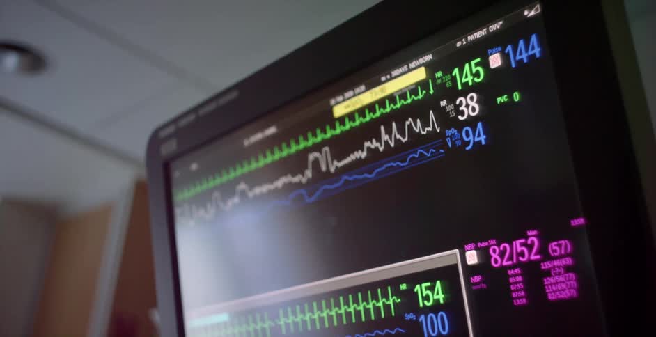 Close up of the digital display of a hospital monitor inside a room