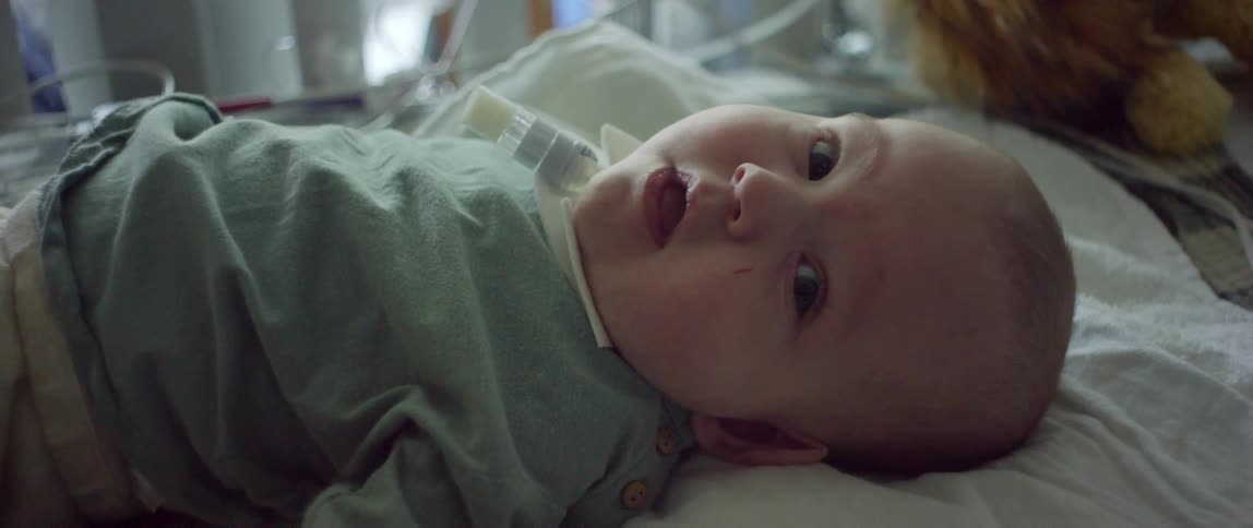 A cute baby lays on its back in a hospital bed with a few tubes connected to it