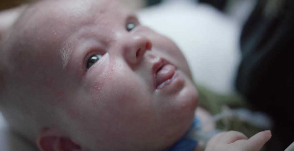 Close up of the face of a baby in a hospital hooked to medical equipment
