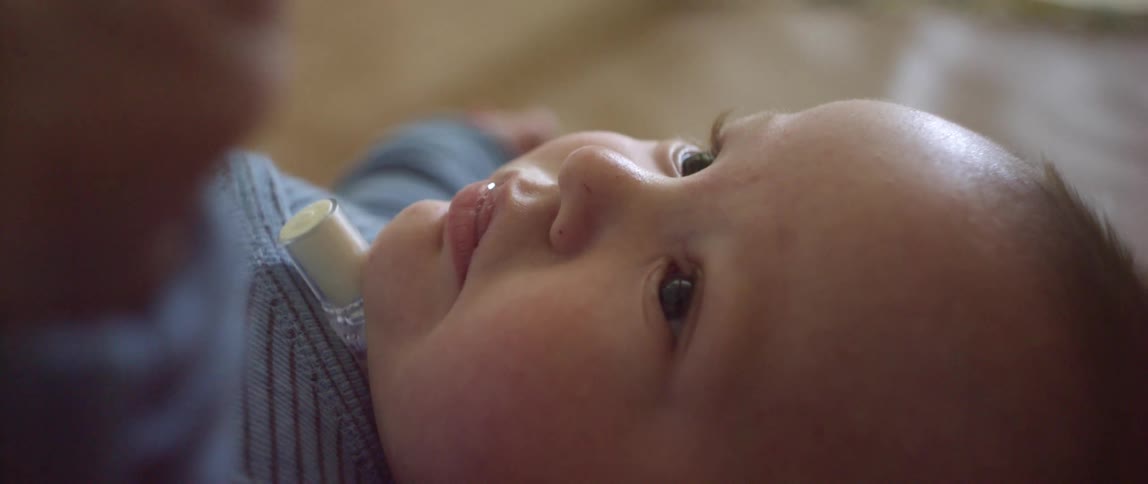 Infant baby with a tracheal immplant laying on the floor at home
