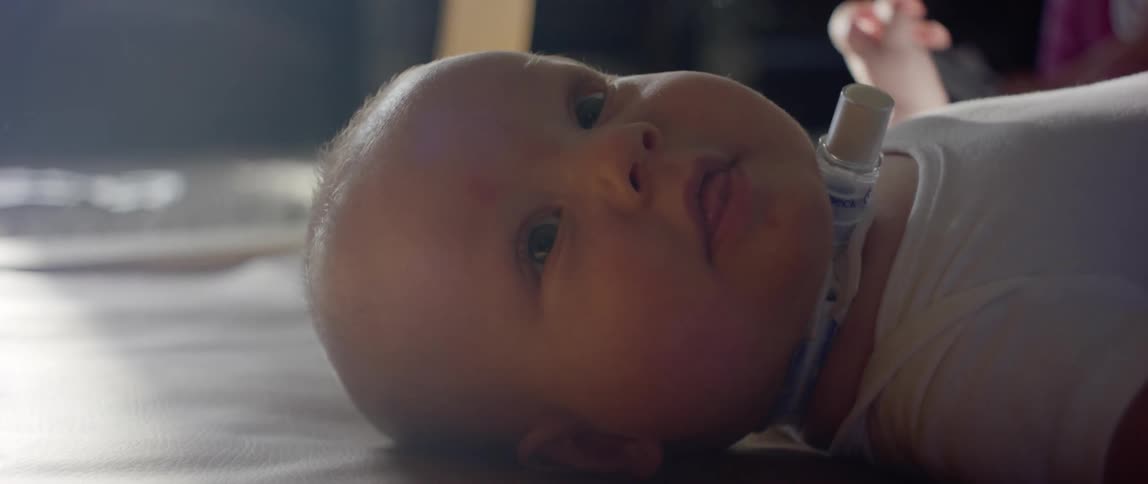 Baby laying on the floor looking at the camera with a tubelike object near its neck
