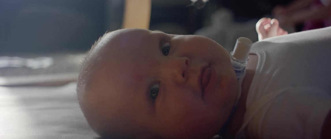 Infant baby with a tracheal implant laying on his back at home