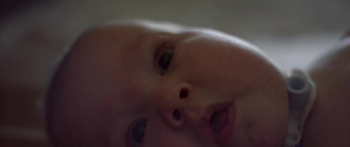 An infant with a tube in its tracheal moves its arms around