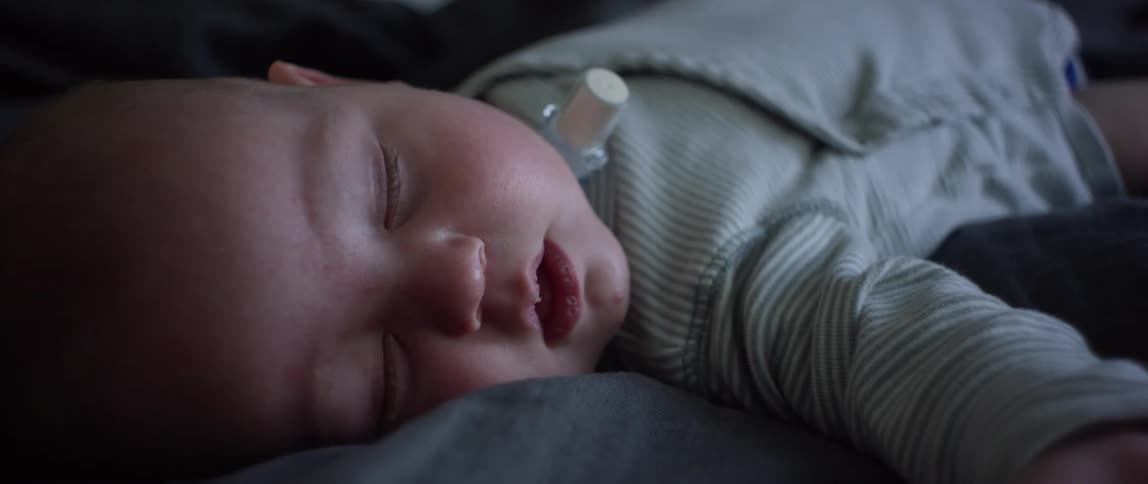 An infant with a medical device around its neck sleeps on its back on a blanket