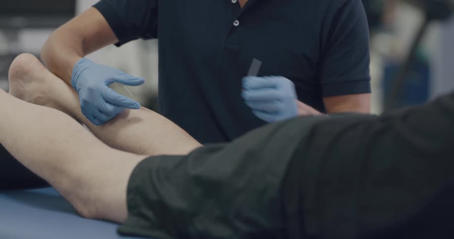 A man in the clinic with gloves performing acupuncture on a persons leg
