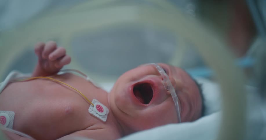 An infact connected to medical equipment cries while lying in a hospital bed