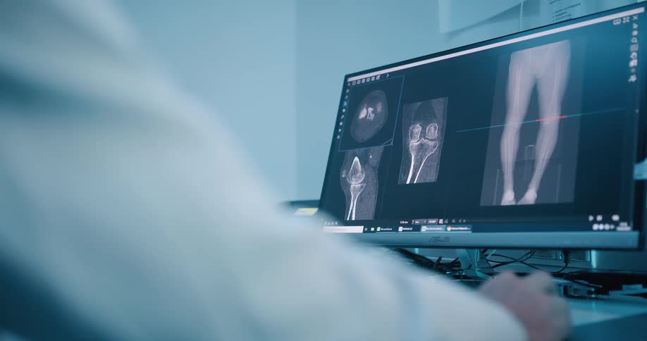 A person sitting at a desk moving a mouse in front of a computer looking at xrays