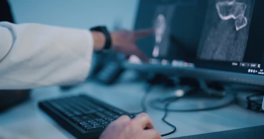 A medical professional reaches up and points at a radiology image displayed on a screen