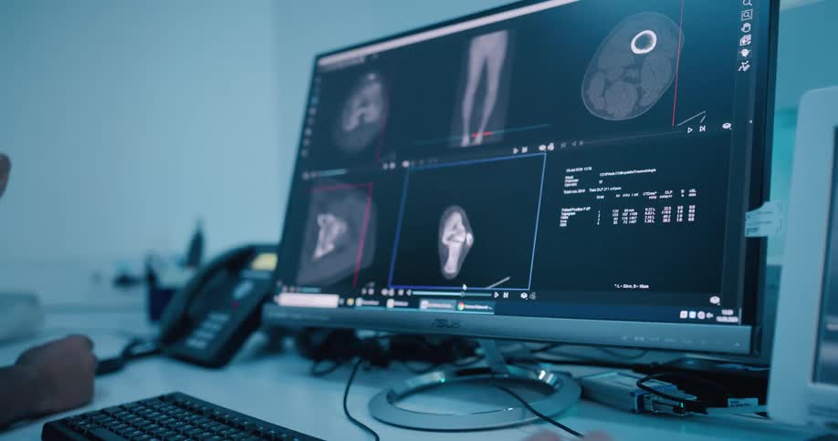 People review x ray images on a monitor