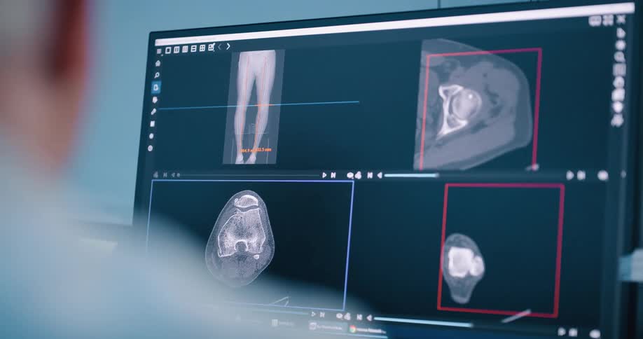 A doctor looking at a body scan displayed on a computer monitor