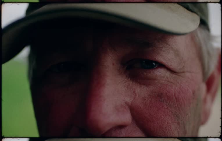 A man with a bright red sunburn across his cheeks wears a baseball cap while posing outdoors