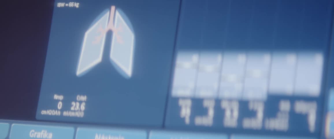 Blue screen of a piece of hospital medical equipment displaying different vitals