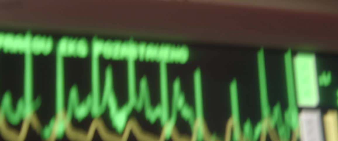 A heart rate monitor machine along with other medical devices in a hospital