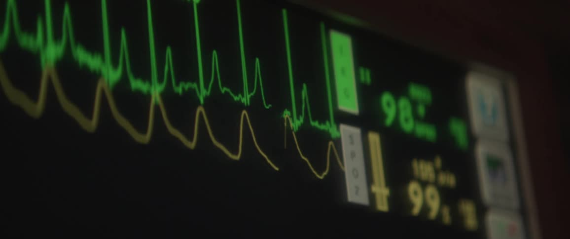 Lines move up and down on a heart monitor in a hospital