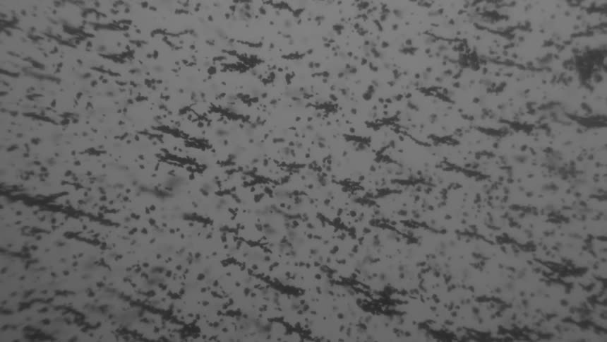 Black specks float in a suspension