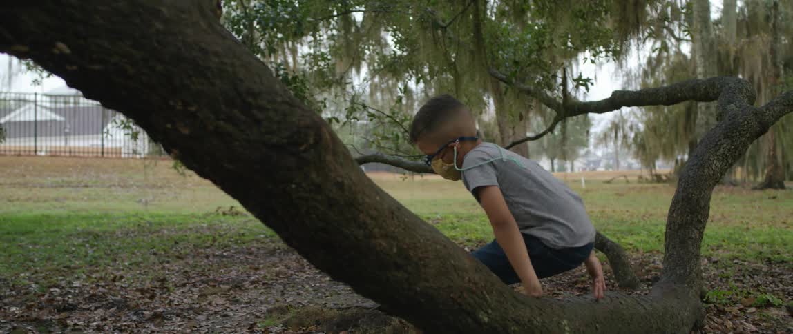 Boy wearing a face mask sits over a branch in the countryside