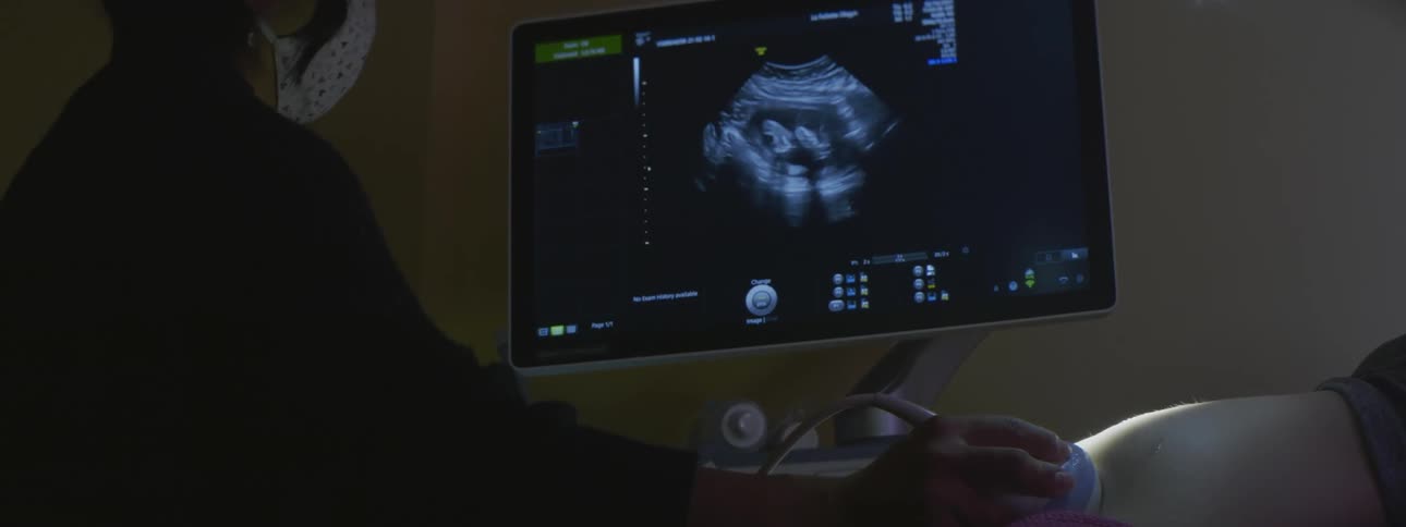 A woman is getting an ultrasound in a doctors office