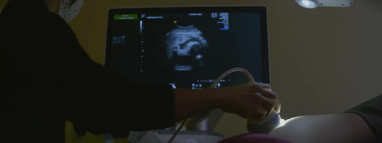 Doctor performing an ultrasound examination of a pregnant woma abdomen