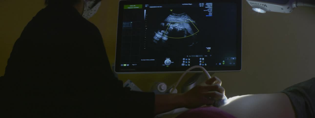 Medical personnel reveals baby using ultrasound in room dimly lit by light focused on mothers abdomen