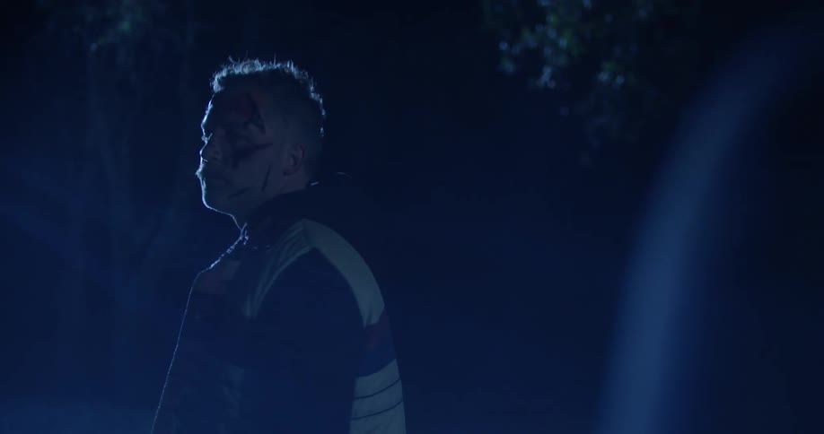 Man standing near trees at night turns to show bloody injured face