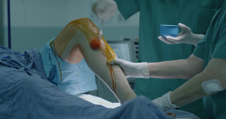 A nurse bends a patients leg while another applies iodine
