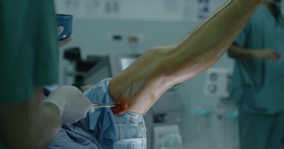 Doctors in the hospital with gloves and mask using a sponge to add a red liquid onto a patients leg with a wall in the background