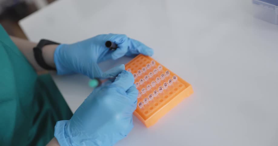 A nurse with scrubs and gloves using a pen to write on test tubes
