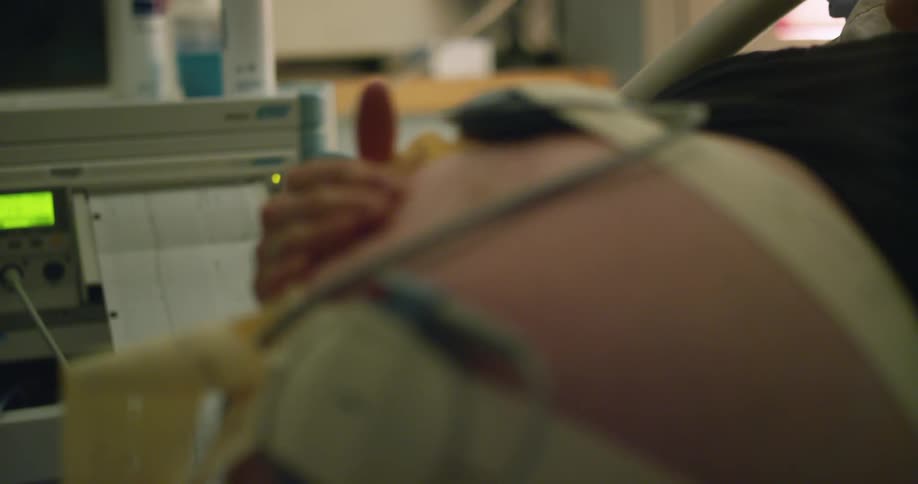 The cables of an ultrasound machine attached to the stomach of a pregnant woman lying in a hospital