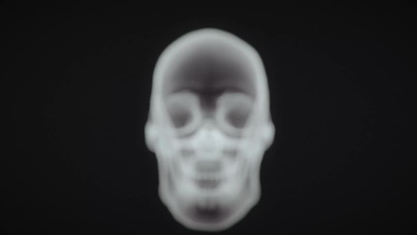 3D X-ray of the human skull