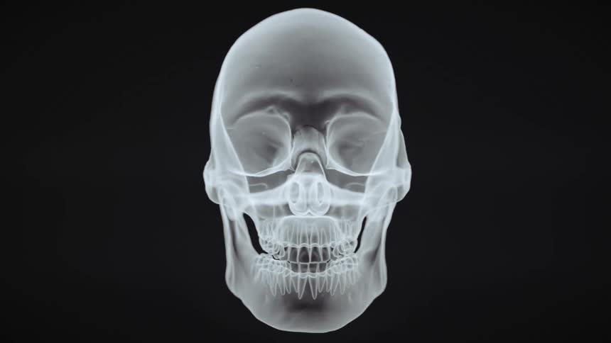 A rotating three dimensional xray of a skull