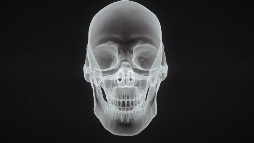 Translucent head in white shows skull against black background