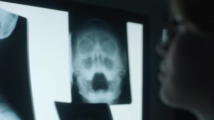 A doctor is looking at xray film using a light