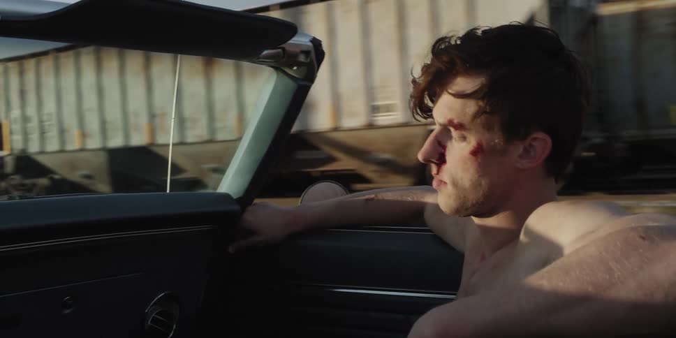 A man riding in a vehicle with bruises on his face with trains the sky and clouds in the background