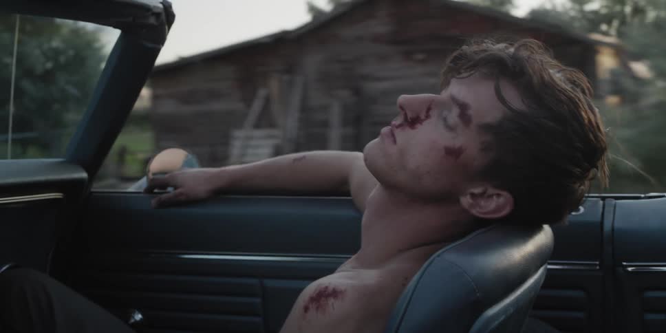 A bloody and beaten man sitting in the passenger seat of a convertible with head back