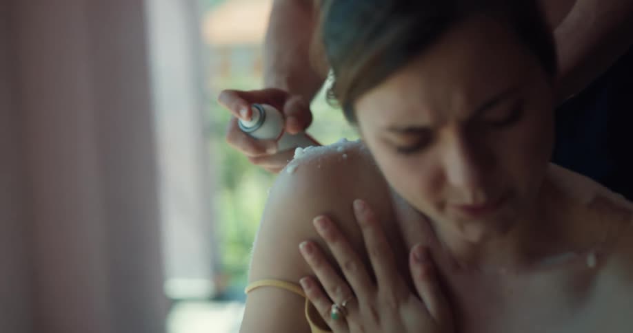 A woman winces as her boyfriend sprays something on her sunburn on her back