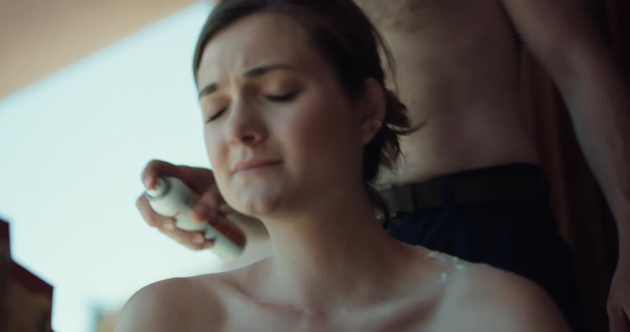 Man applying spray to the burnt back of a woman sitting outdoors