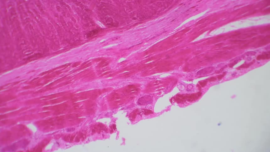 Muscle is slid under a microscope lens