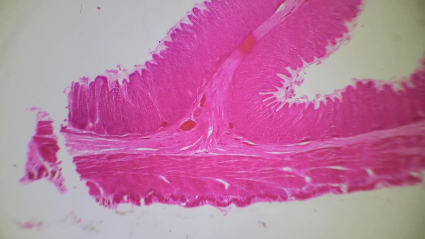 Muscle tissue is seen under a microscope