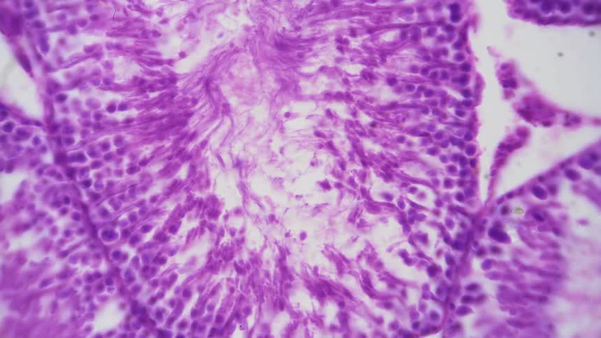 A biological cross section of an organ is seen under a microscope