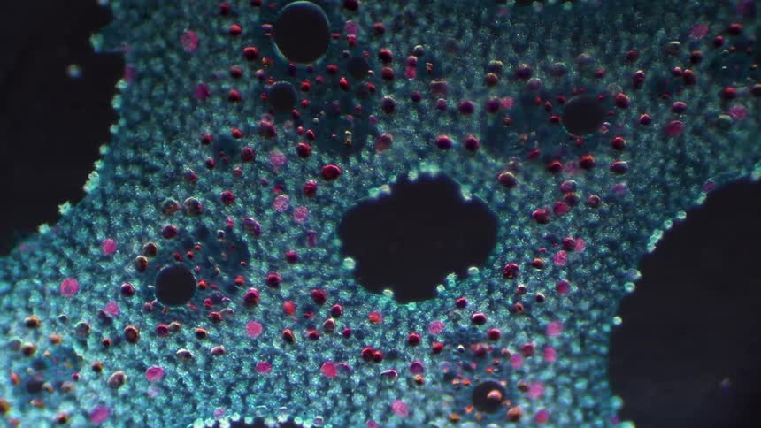 A microscope focuses in on a blue and red substance on a slide