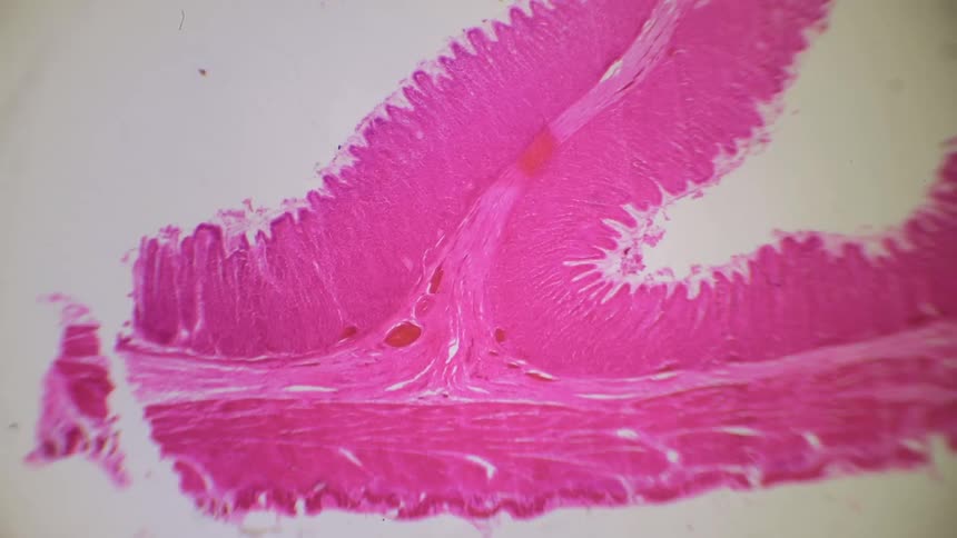 A scientist sees muscle tissue comes into focus under a microscope