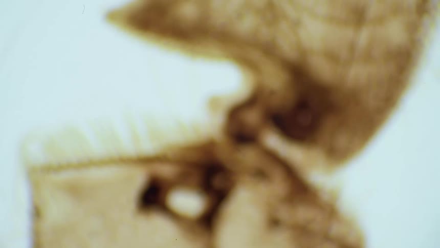 A scientist magnifies an insect under a microscope