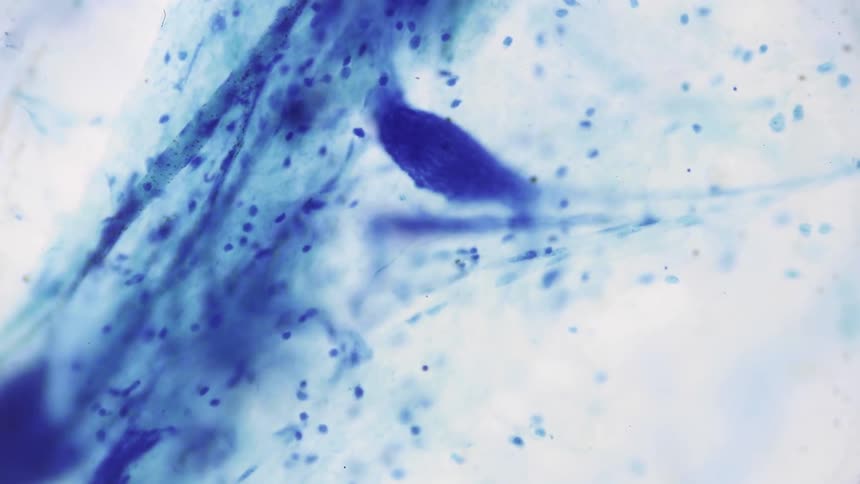 The nervous system of an insect is seen under a microscope