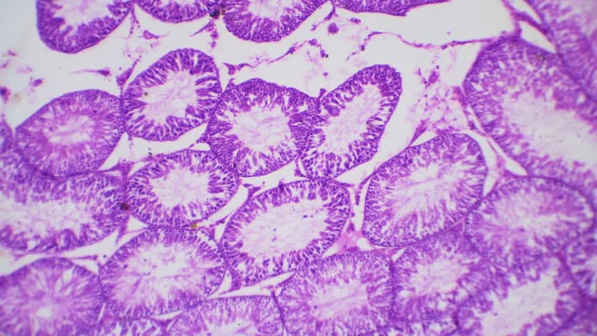 A microscope slide comes into focus and we see a cross section of anatomy