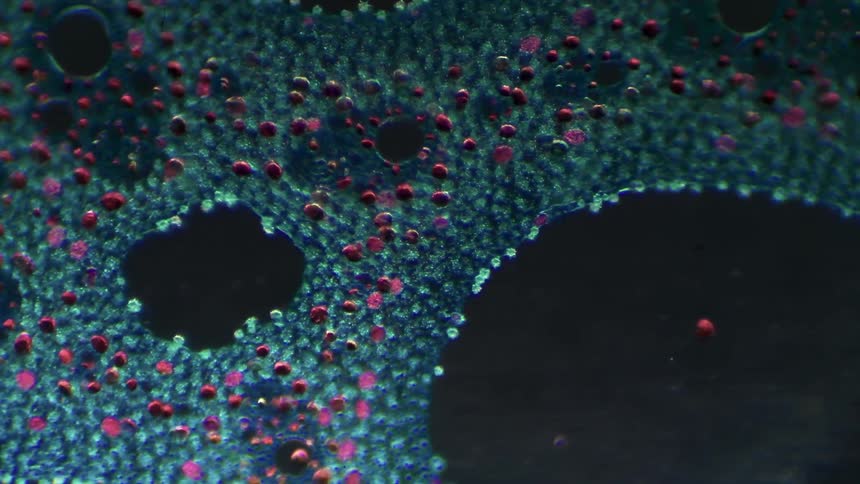 A microscope focusses on bacteria on a slide