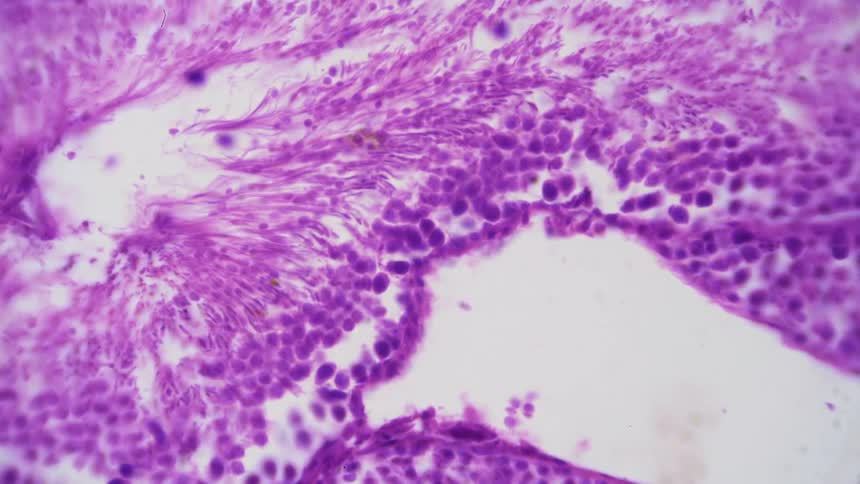 A microscope reveals an organic structure on a slide