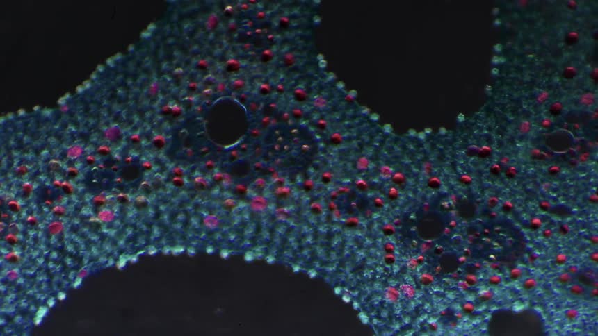 A scientist reviews bacteria under a microscope